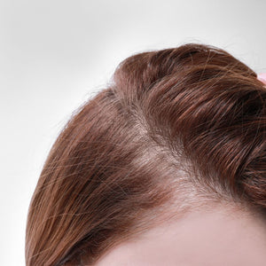 Telogen Effluvium